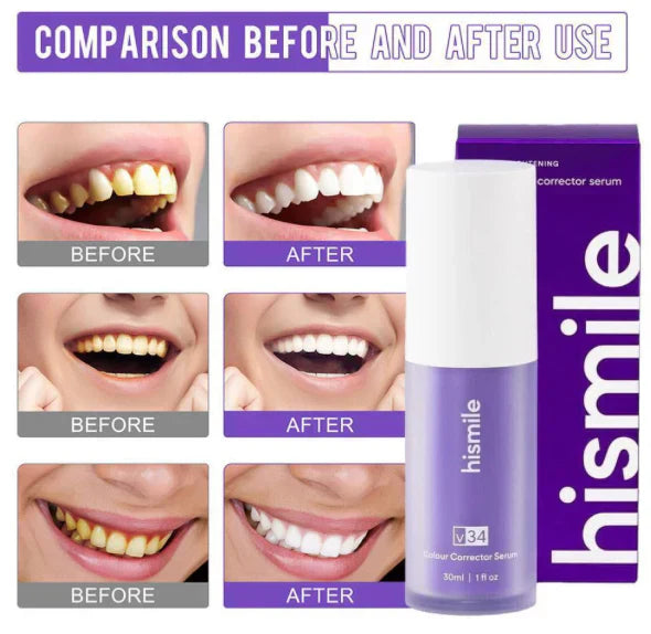Hi Smile Teeth Whitening Serum V34 Without Sensitivity