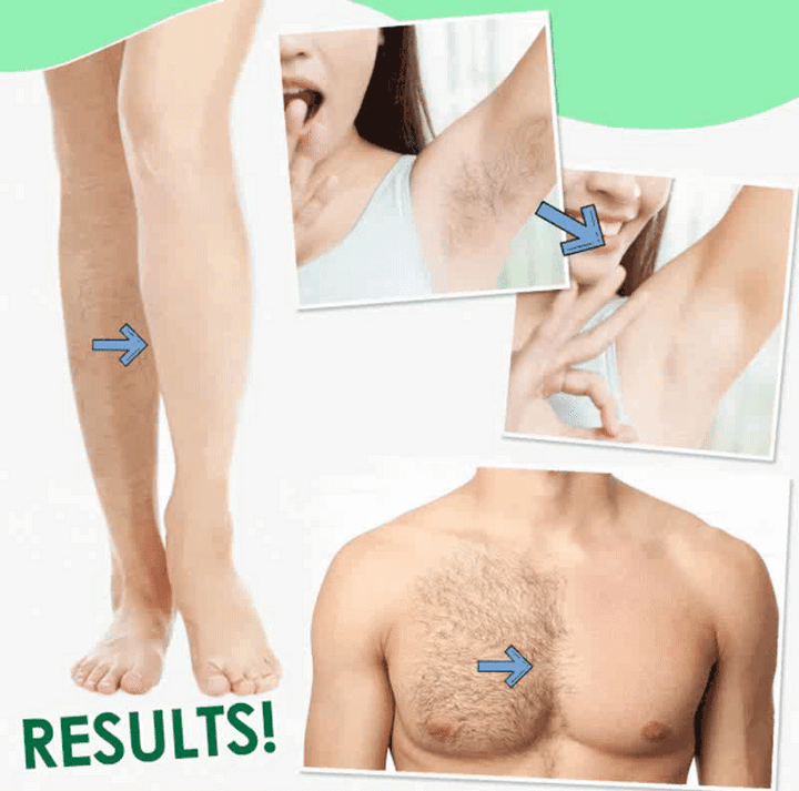 Sydonic Permanent Facial Hair Removal Cream for Smooth